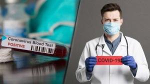 Satgas Bentuk Tim Khusus Monitoring Dokter Terinfeksi Covid-19